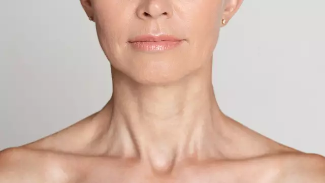 The rise of ‘Ozempic neck’