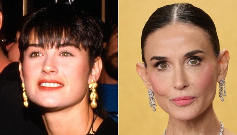 Demi Moore Sparks ‘Ozempic Ears’ Accusations At 2026 Actor Awards