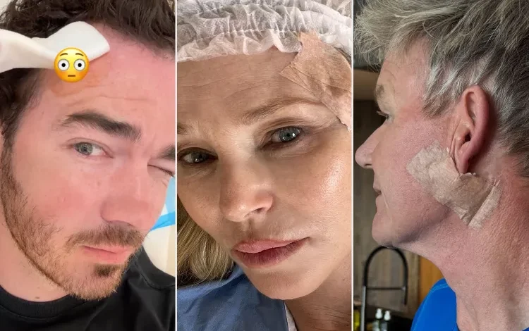 Celebs Who Beat Skin Cancer  and How They Prevent It Now